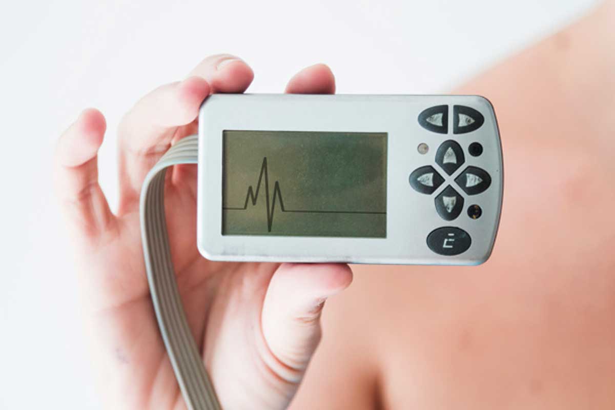 ECG